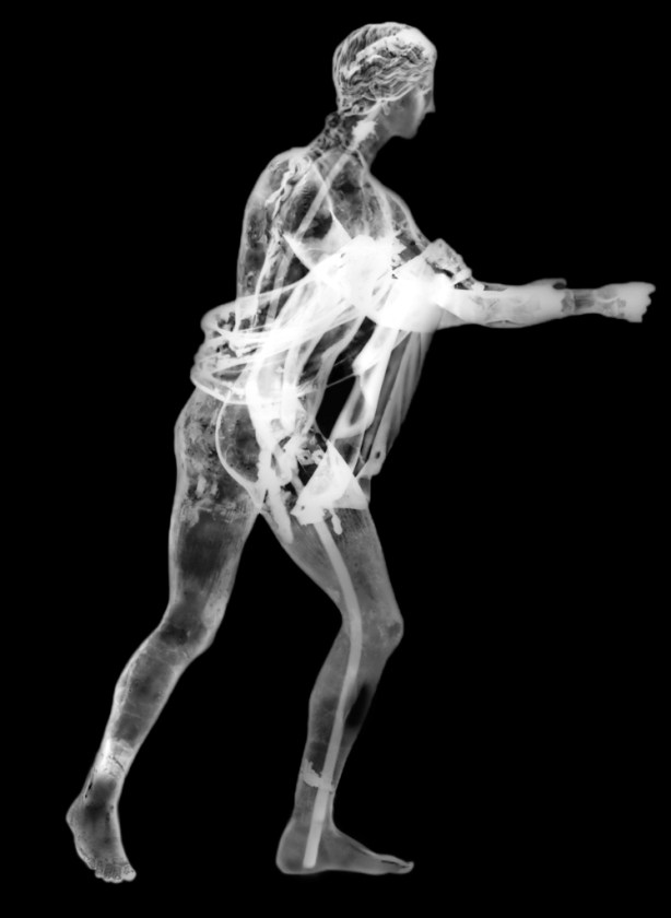 Apollo X_Ray_withFeet